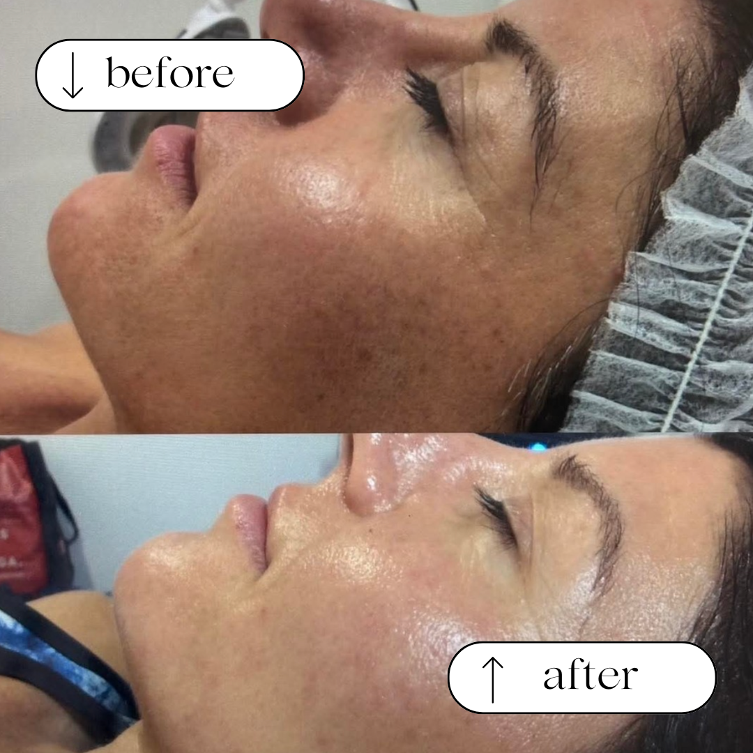 Body Wisdom Perth before and after treatment result
