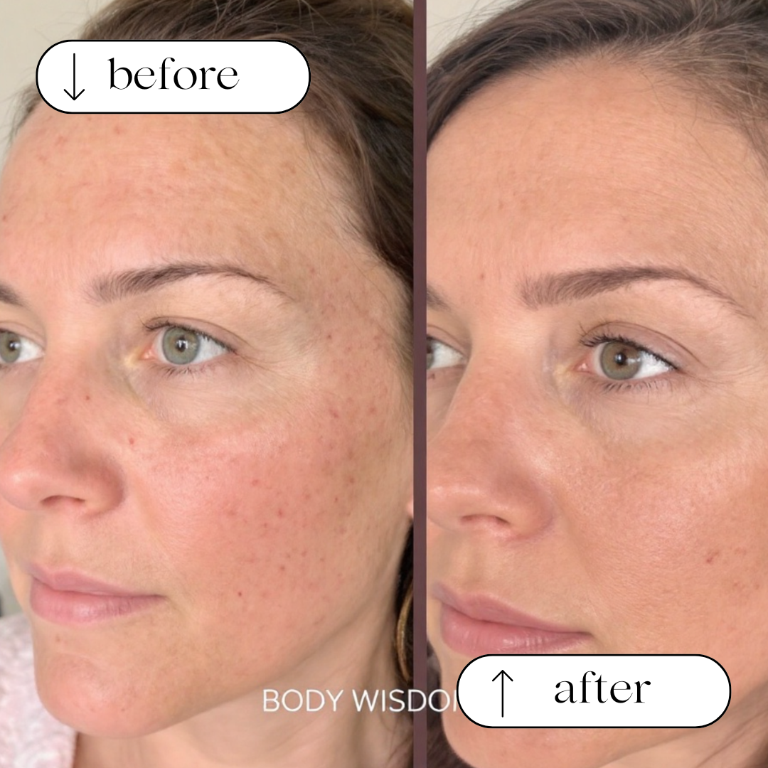 Body Wisdom Perth before and after treatment result